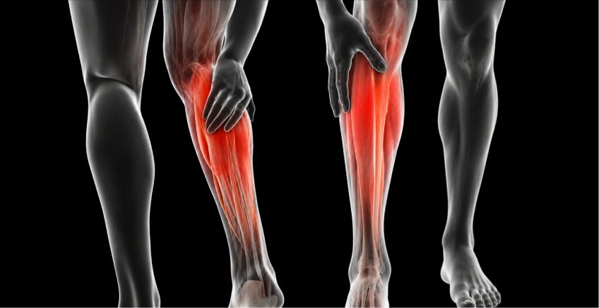 Normal pump compared with abnormal calf pump