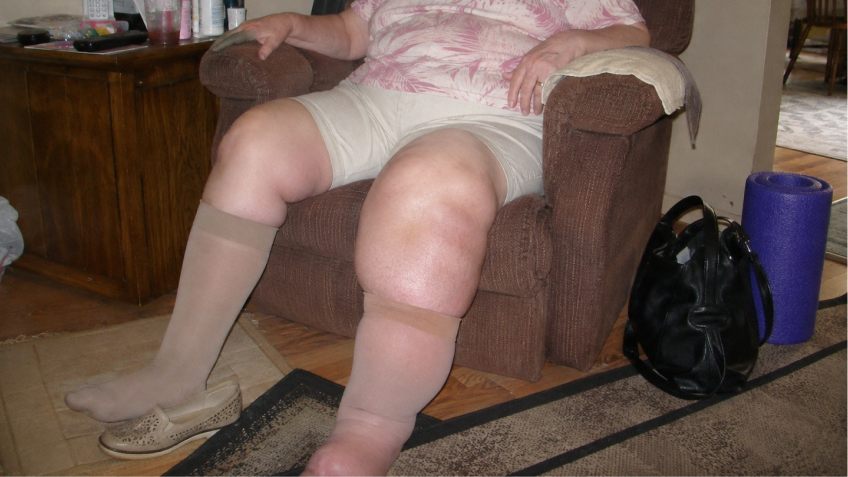 Compression socks